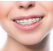 Person with retainer on teeth