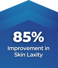 85-percent-improvment-in-skin-laxity
